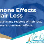 Saç Dökülmesinde Hormon Etkileri